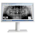 Monitore